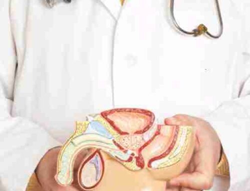 Tratamiento para la Hiperplasia Prostática Benigna (BPH)