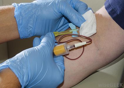 Ketones in Blood Test