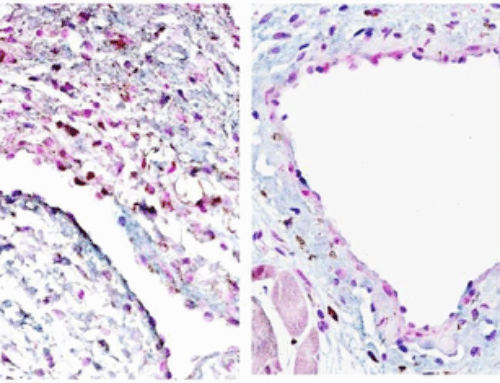 Células madre ofrecen nueva esperanza para pacientes renales: hallazgo de Mayo Clinic
